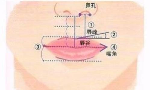 厚唇改薄術.jpg