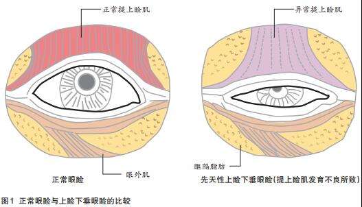 死魚(yú)眼.jpg